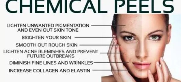 benefits of chemical peels