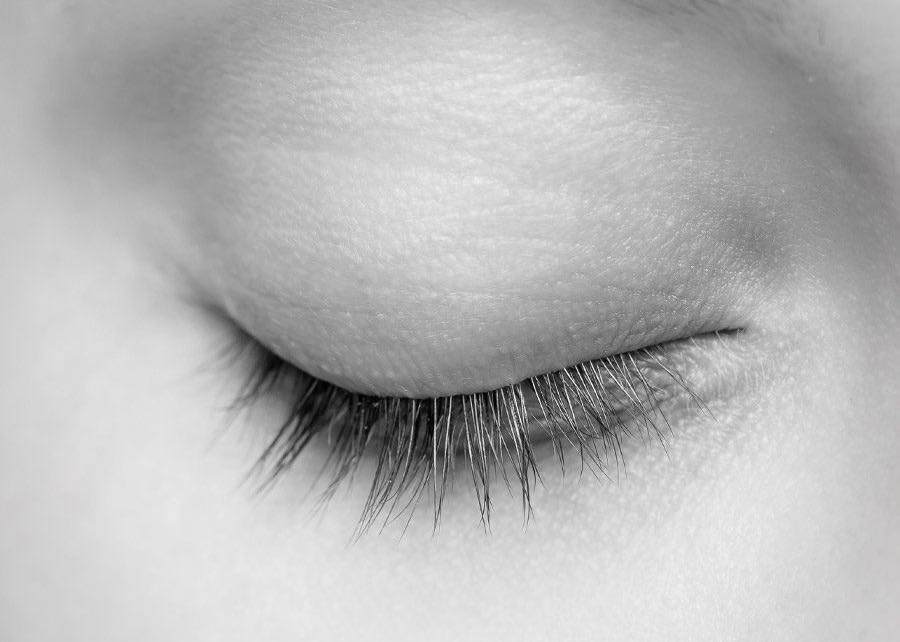 close up of a woman eye closed with long lashes after periorbital lumps removal treatment monotone