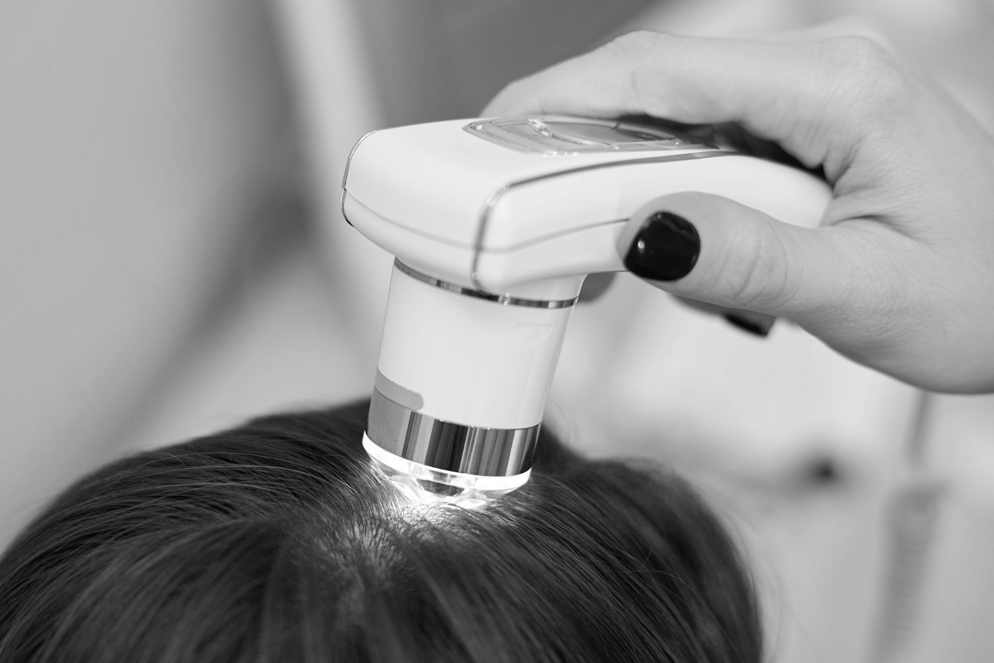 Low Level Laser Therapy (LLLT) on a woman’s scalp